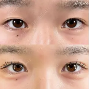 R Beauty CLINIC 銀座院 富田 莉沙子医師の症例