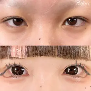 R Beauty CLINIC 銀座院 富田 莉沙子医師の症例