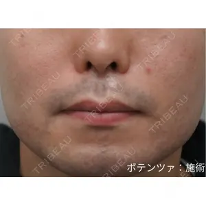ドクタープチ美容クリニック -弘大店の症例