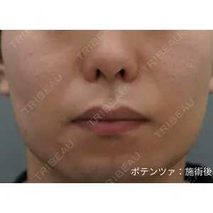 ドクタープチ美容クリニック -弘大店の症例
