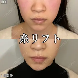 形成外科と美容外科のクリニック池袋 春日 航医師の症例
