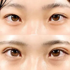 R Beauty CLINIC 名古屋院 木村 尚大医師の症例