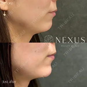 NEXUS CLINICの症例