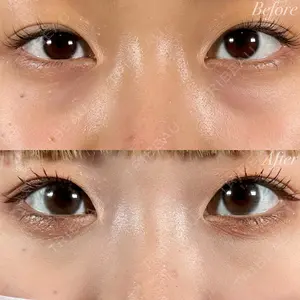 R Beauty CLINIC 名古屋院 木村 尚大医師の症例