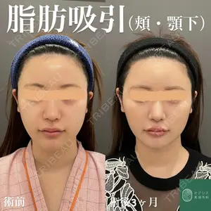 オアシス美容外科 遠藤 剛史医師の症例