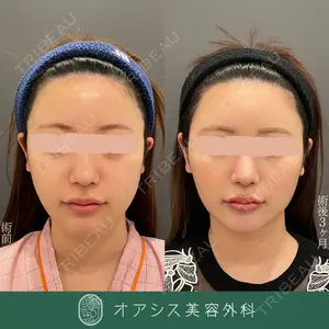 オアシス美容外科 遠藤 剛史医師の症例
