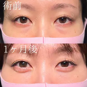 HAAB×DREAM BEAUTY CLINIC 大阪梅田院 鈴木 馨斗医師の症例