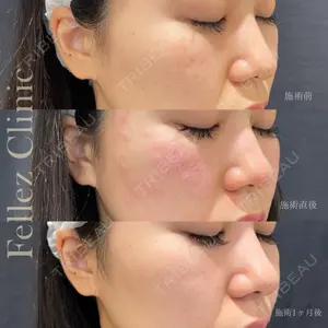 Fellez Clinic【フェルズクリニック】の症例