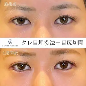 LOUIS CLINIC 二子玉川院【ルイクリニック】 小松 塁医師の症例