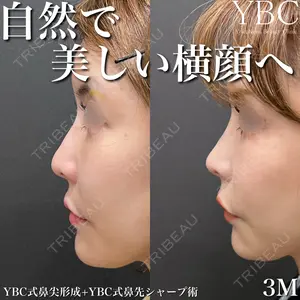 YBC横浜美容外科 大宮院 磯村 亮輔医師の症例