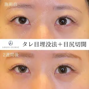LOUIS CLINIC 二子玉川院【ルイクリニック】 小松 塁医師の症例