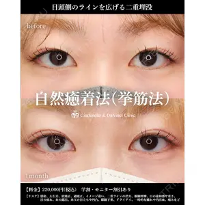 シンデレラ＆ダヴィンチクリニック 宮田 洋佑医師の症例