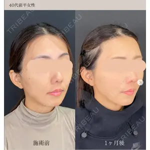 自由が丘ウェルエイジングビューティークリニックの症例