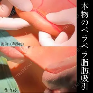 ヴェルトラクリニック 新宿院 伊藤　優医師の症例
