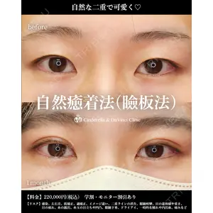 シンデレラ＆ダヴィンチクリニック 宮田 洋佑医師の症例
