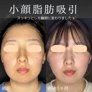 ルラ美容クリニック 仙台院の症例