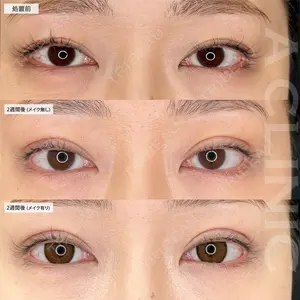 A CLINIC（エークリニック） 仙台院 伊藤 瑠桂医師の症例
