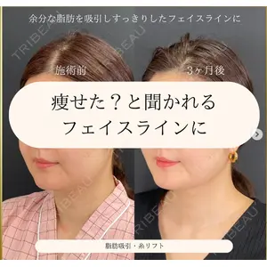 自由が丘ウェルエイジングビューティークリニックの症例