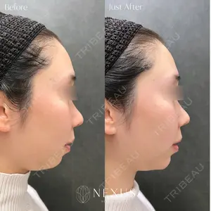 NEXUS CLINIC 岩井 勝矢医師の症例