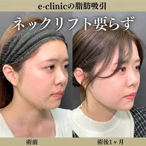 eクリニック 横浜みなとみらい院 八ヶ代 康将医師の症例