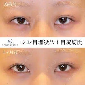 LOUIS CLINIC 二子玉川院【ルイクリニック】 小松 塁医師の症例