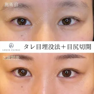LOUIS CLINIC 二子玉川院【ルイクリニック】 小松 塁医師の症例