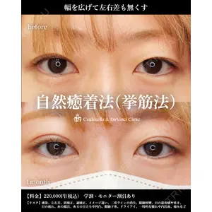 シンデレラ＆ダヴィンチクリニック 宮田 洋佑医師の症例