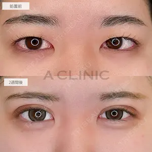 A CLINIC（エークリニック） 池袋院 三橋 克之医師の症例