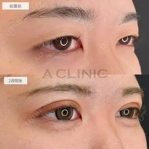 A CLINIC（エークリニック） 池袋院 三橋 克之医師の症例
