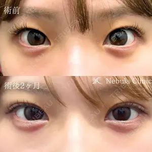 ネビュラクリニック 広島院 穴井　元康医師の症例