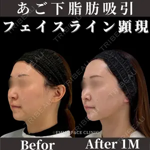 EMMO FACE CLINIC 東京三田院 木之下 哲彦医師の症例
