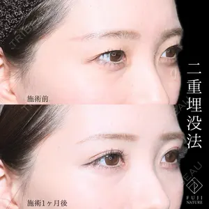 藤・ナチュレ美容クリニック 銀座院 小川 杏平医師の症例