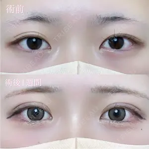 仙台N美容クリニック 小阪 捺稀医師の症例