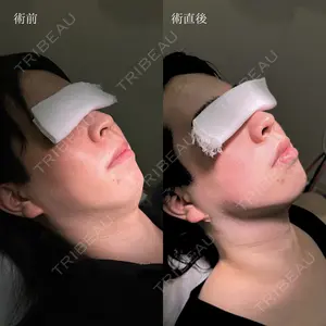 HAAB×DREAM BEAUTY CLINIC 東京本院 吉岡 修一医師の症例