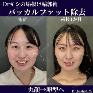 ネビュラクリニック 京都院 岸 大輔医師の症例