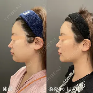 オアシス美容外科 遠藤 剛史医師の症例