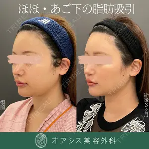 オアシス美容外科 遠藤 剛史医師の症例