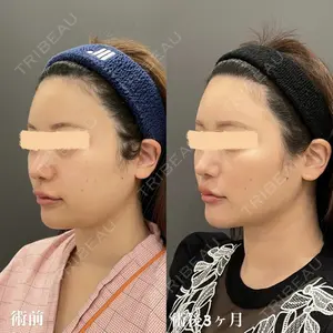 オアシス美容外科 遠藤 剛史医師の症例