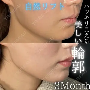 THE FIRST CLINIC 多摩センター院 惟村 公郁医師の症例