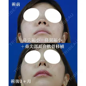 リッツ美容外科 大阪院の症例
