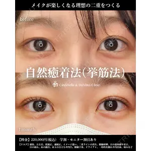 シンデレラ＆ダヴィンチクリニック 宮田 洋佑医師の症例