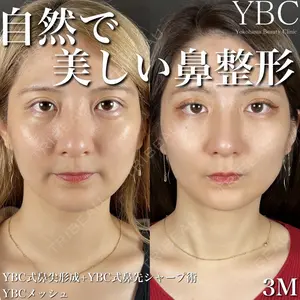 YBC横浜美容外科 立川院の症例