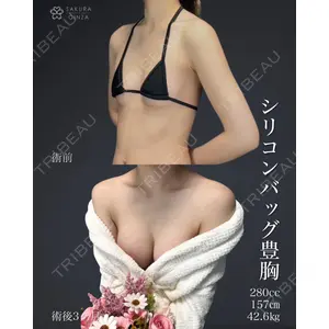 さくらビューティークリニック銀座 富田 さくら医師の症例