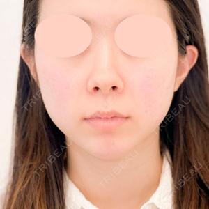 A CLINIC（エークリニック） 新宿院 山田 哲雄医師の症例