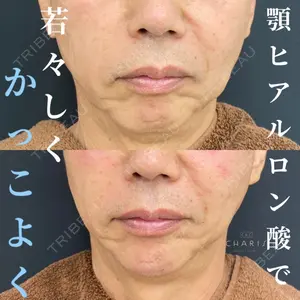 CHARIS BEAUTY CLINICの症例