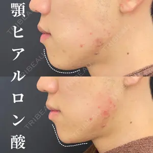 CHARIS BEAUTY CLINICの症例