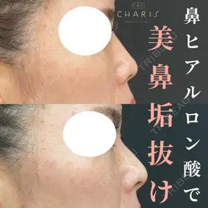 CHARIS BEAUTY CLINICの症例