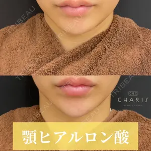 CHARIS BEAUTY CLINICの症例