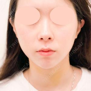 A CLINIC（エークリニック） 新宿院 山田 哲雄医師の症例