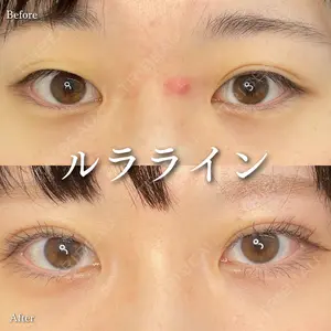 ルラ美容クリニック 渋谷本院 住友 沙織医師の症例